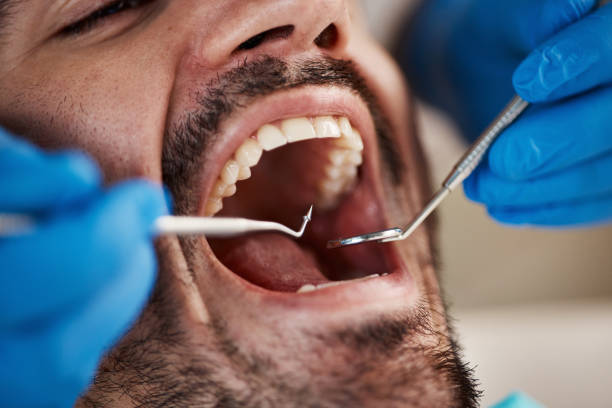 Best Emergency Treatment for Dental Infections or Abscesses in Somersworth, NH